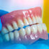 dentures